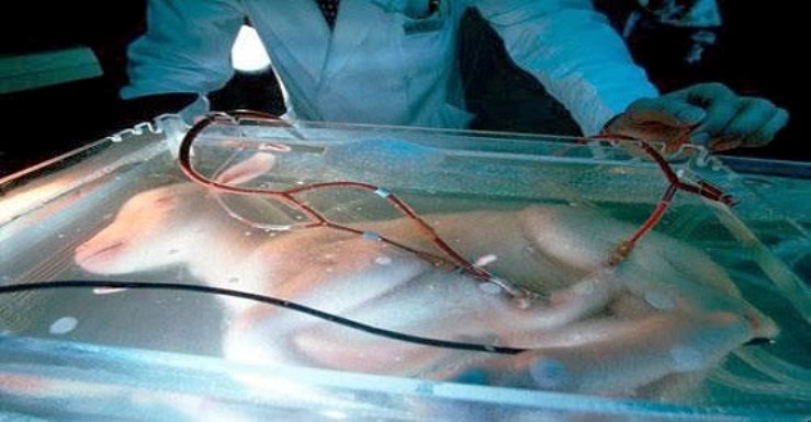 artificial-womb